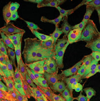 Image: In mammary epithelial cells in which the Sox4 transcription factor is missing this change is not apparent, and cancer cells cannot metastasize (Photo courtesy of Dr. Nathalie Meyer-Schaller, University of Basel).